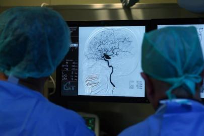 Erken müdahale, inme sonrası yaşam kalitesini artırıyor