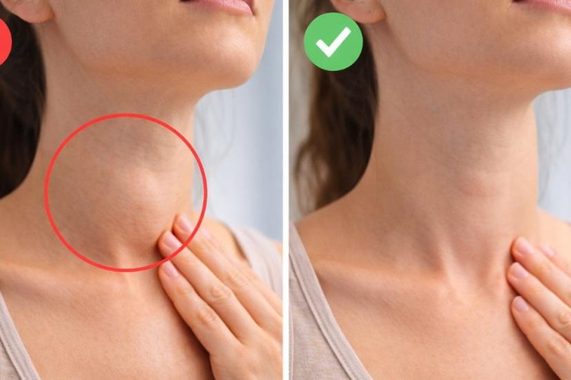 Evde tiroid kontrolü: Aynaya geçin, hemen deneyin...