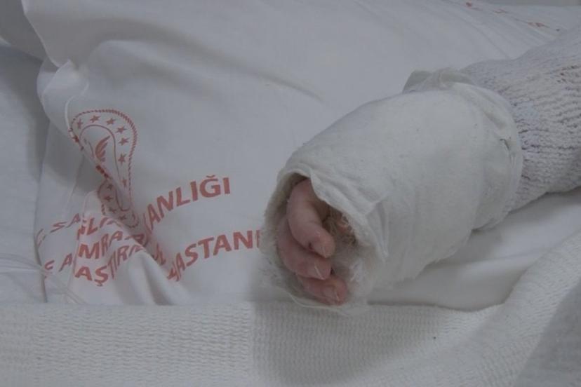 İstanbul'da bebeğin üzerine kaynar su döküldü: Vücudunun yüzde 27'si yandı