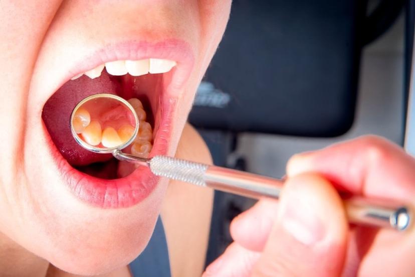 Şişen damaklara dikkat: İşte yaptığınız hata